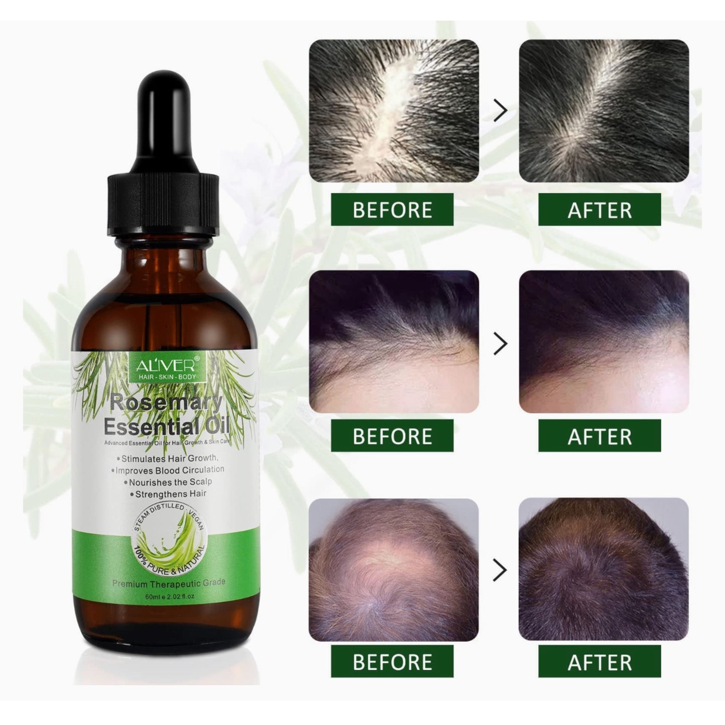 ALIVER Rosemary Oil for Hair Growth, Rosemary Essential Oil, Nourishes Scalp, Strengthens Hair and Stimulates Hair Growth - 2oZ