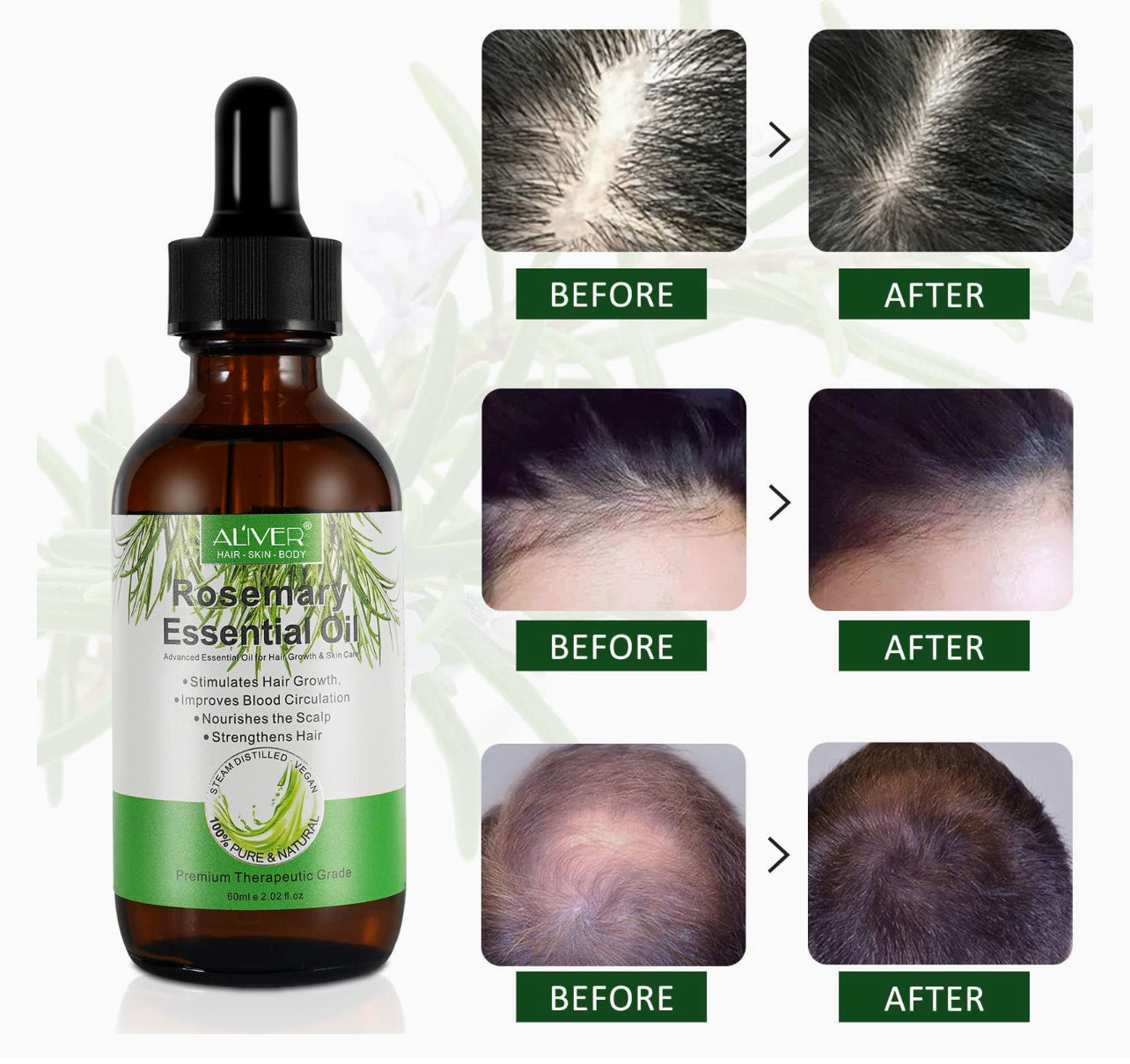 ALIVER Rosemary Oil for Hair Growth, Rosemary Essential Oil, Nourishes Scalp, Strengthens Hair and Stimulates Hair Growth - 4oZ